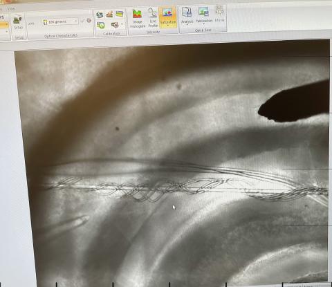  A microscope image displayed on a computer screen showing a mouse hippocampal brain slice with stimulus and recording electrodes inserted in it.