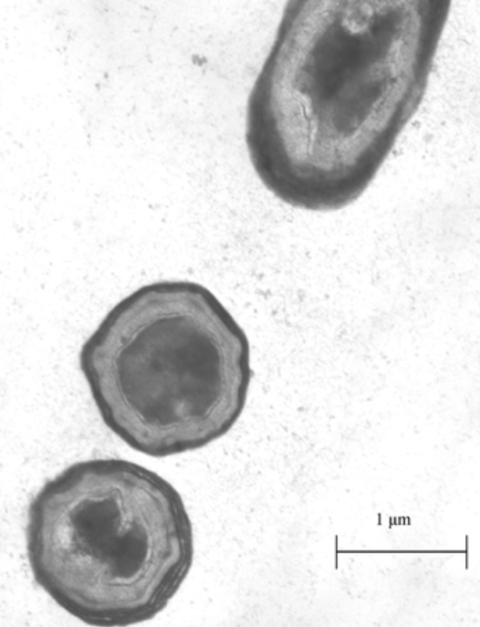 Thomas Figure 1