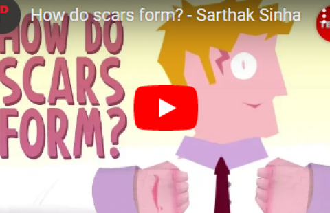 Thumbnail for the video on how scars form