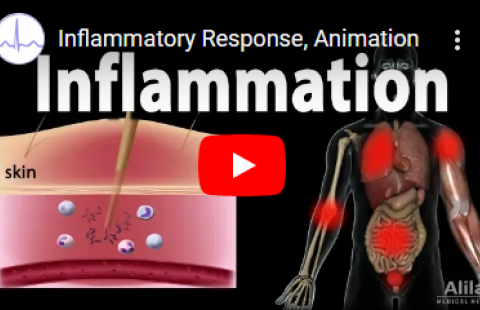 Thumbnail for the video on the inflammatory response