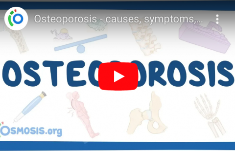 Osteoporosis youtube screenshot