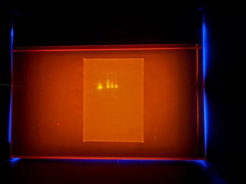 gel electrophoresis