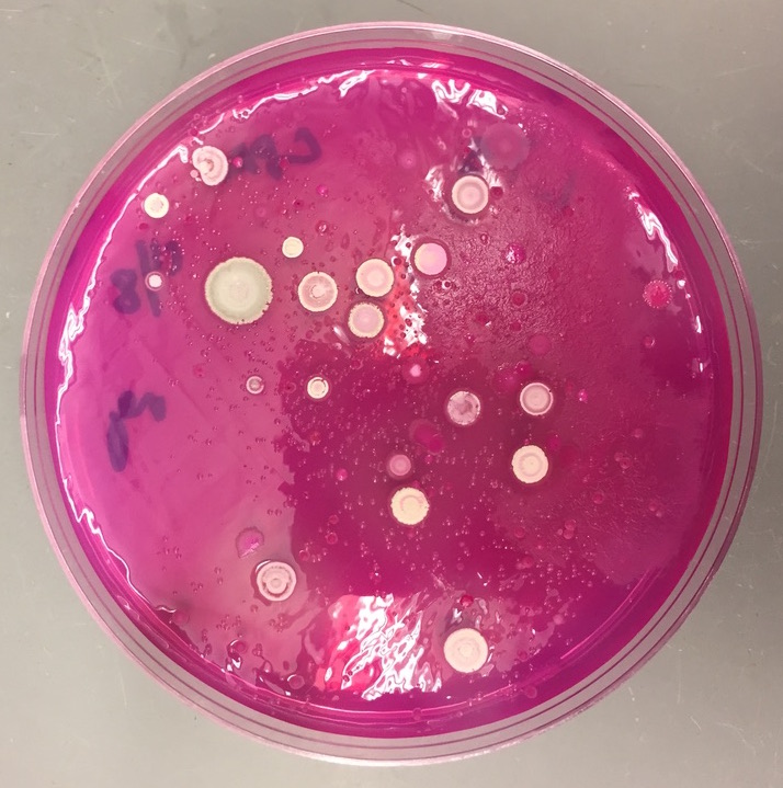 Bacteria in petri dish