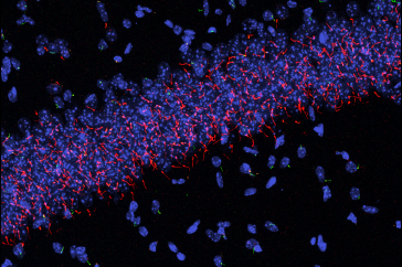 Neuronal primary cilia in the hippocampus