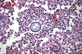 slide of coccidioides fungus 